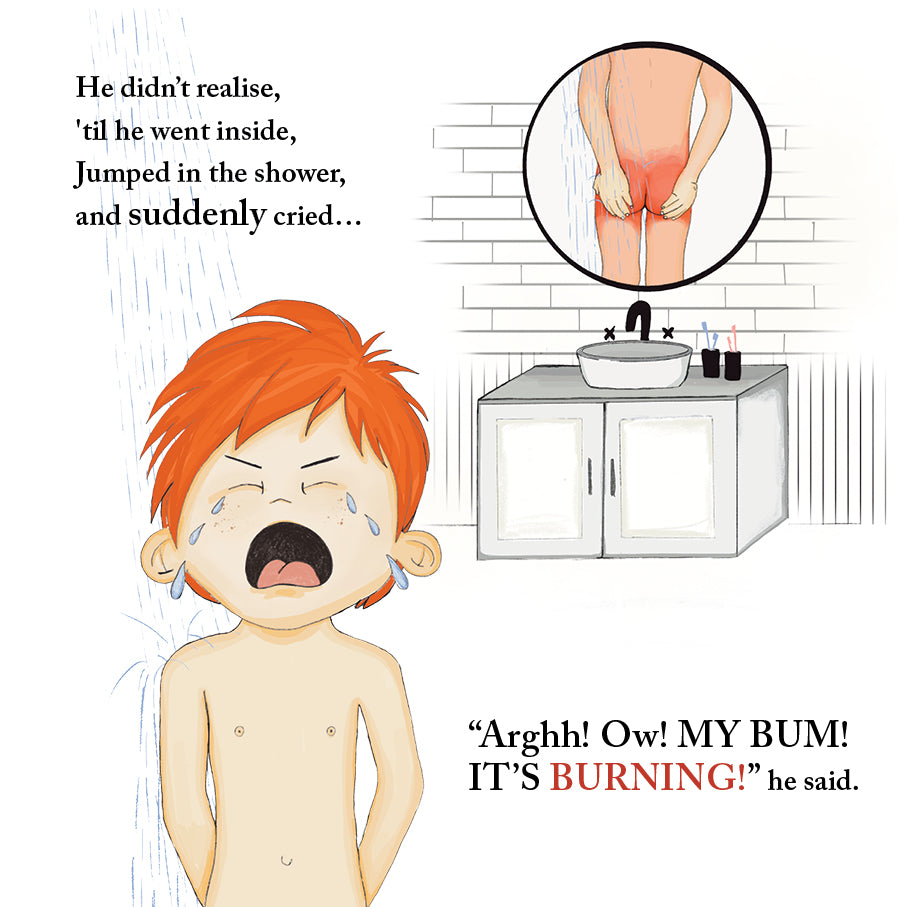 The Adventures of Willy and his Sunburnt Bum! Children's book